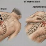Why Should I See an Out-of-Network Spine Specialist?