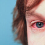 Recognizing Allergy Symptoms and Knowing When To Seek Help