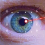 Understanding the Risks and Benefits of Laser Eye Surgery