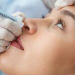 How Botox Can Help with Migraines and Other Medical Conditions