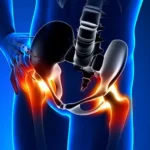 Hip Pain and Its Connection to Overall Mobility