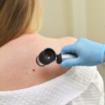 How to Monitor Changes in Skin Cancer Over Time