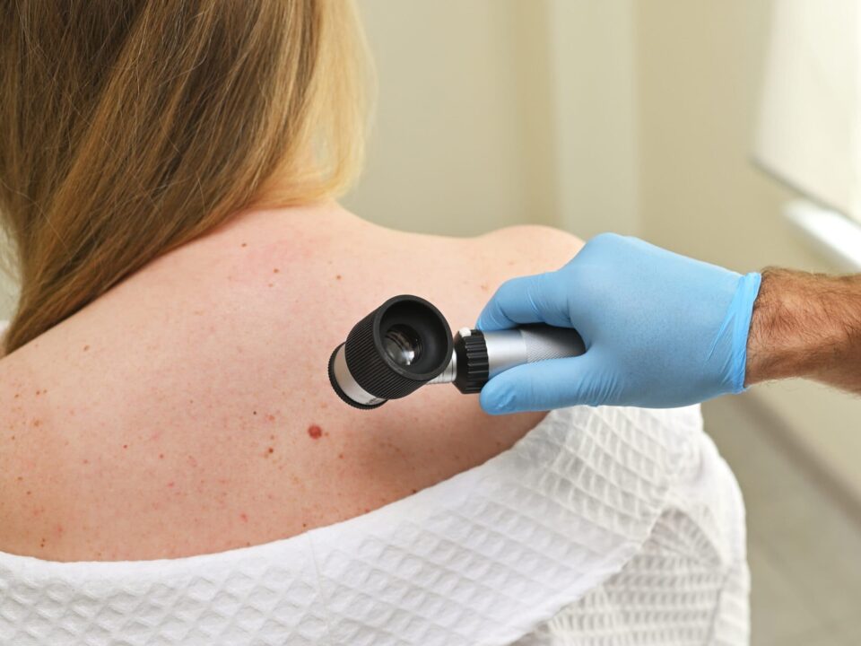 How to Monitor Changes in Skin Cancer Over Time