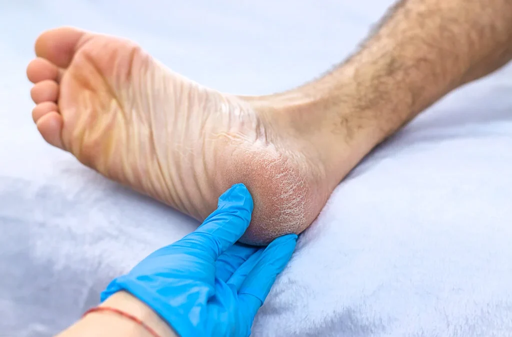 Knowing When to See a Podiatrist