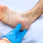 Knowing When to See a Podiatrist