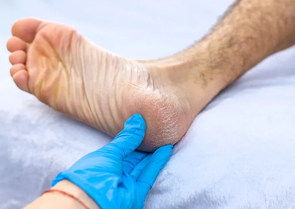Knowing When to See a Podiatrist