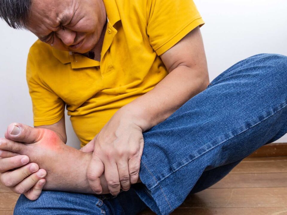 Lifestyle Adjustments for Managing Gout Effectively
