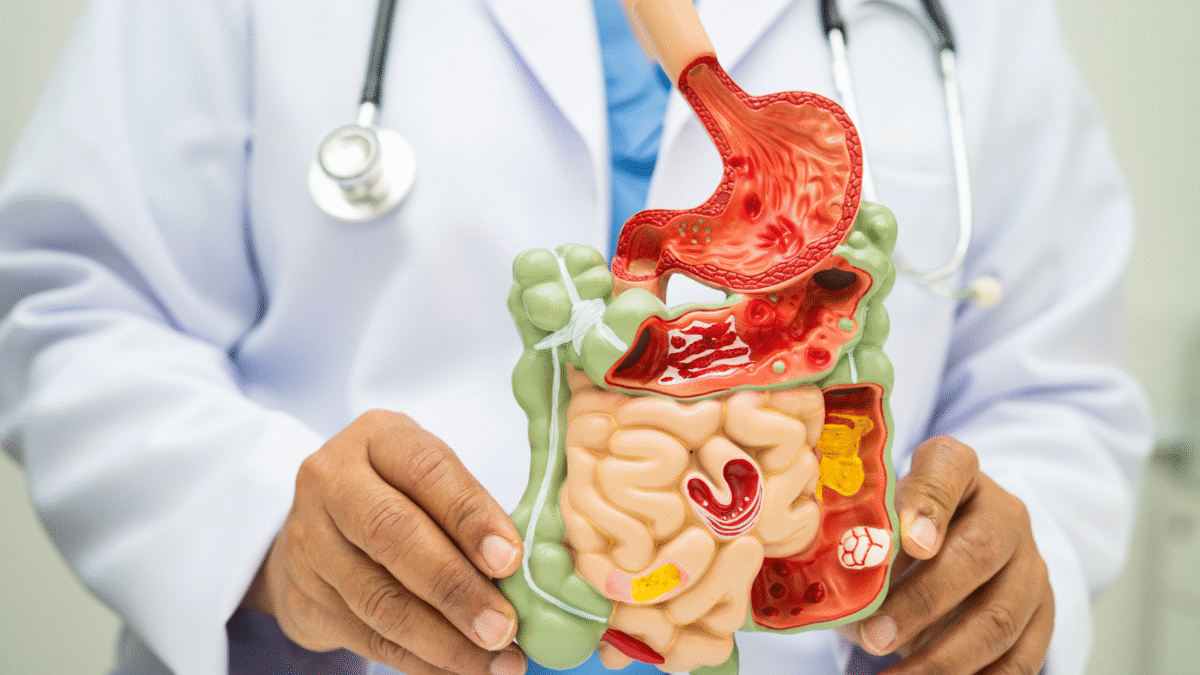 The Benefits of Getting Colon Cancer Surgery