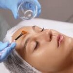 The Role of Chemical Peels in Your Skincare Routine