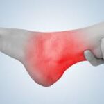 Understanding the Recovery Process for Ankle Sprains