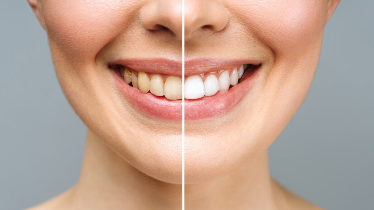 What Services Does a Cosmetic Dentist Provide?