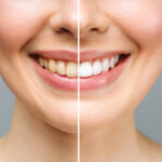 What Services Does a Cosmetic Dentist Provide?