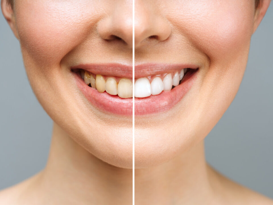 What Services Does a Cosmetic Dentist Provide?