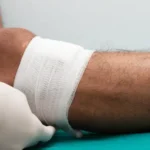 Dos and Don'ts for Ankle Wound Care