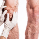Exploring the Connection Between Vascular Disease and Diabetes