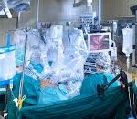 FAQs About Da Vinci Surgery