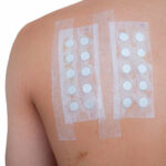 Long-term Benefits of Allergy Shots