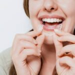 The Advantages of Clear Aligners