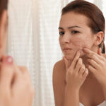 Understanding Causes and Treatment Options for Acne Scarring